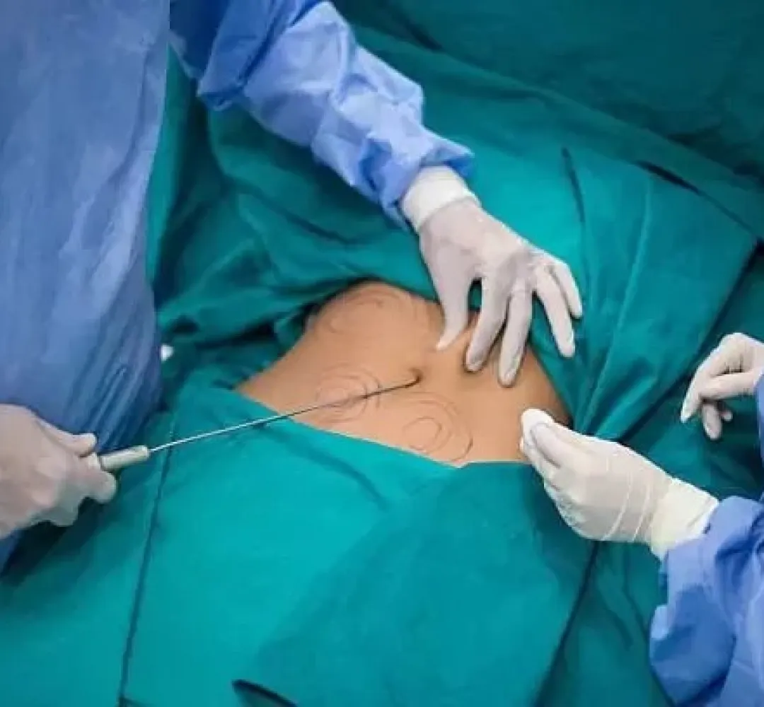 مصممة أزياء مغربية انتقلت الى رحمة الله أثناء خضوعها لعملية تجميل بطنجة